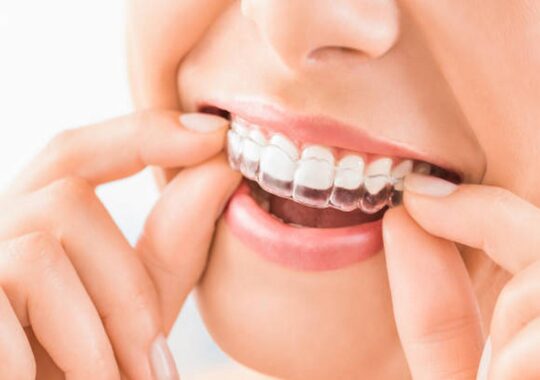 Reasons Why Invisalign Is A Right Decision For Straightening Your Teeth?