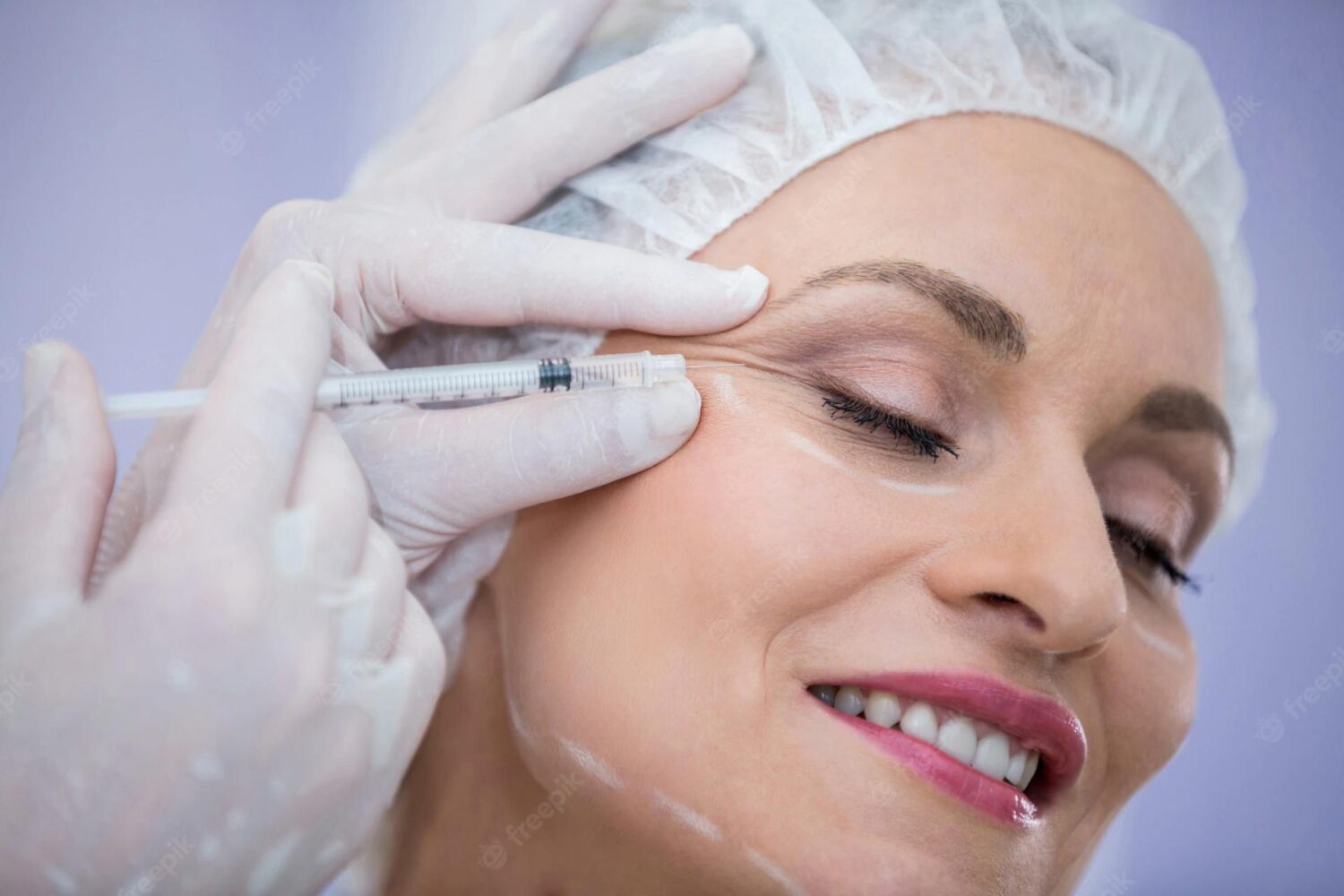 When to Choose Dermal Filler Over Botox